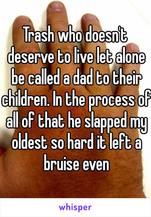 Trash who doesn't deserve to live let alone be called a dad to their children. In the process of all of that he slapped my oldest so hard it left a bruise even