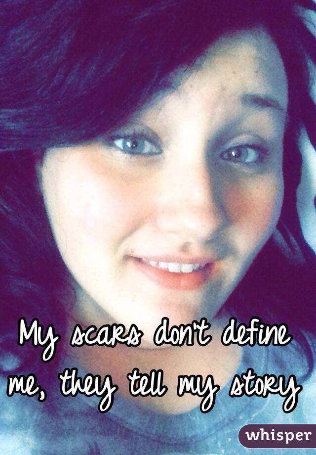 My scars don't define me, they tell my story 
