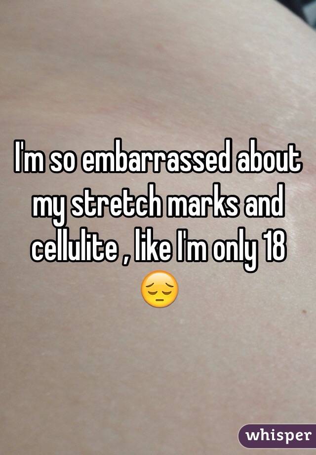 I'm so embarrassed about my stretch marks and cellulite , like I'm only 18 😔