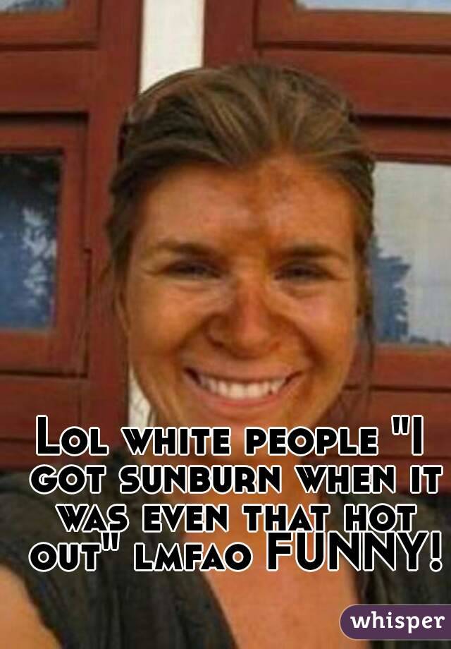 Lol white people "I got sunburn when it was even that hot out" lmfao FUNNY!