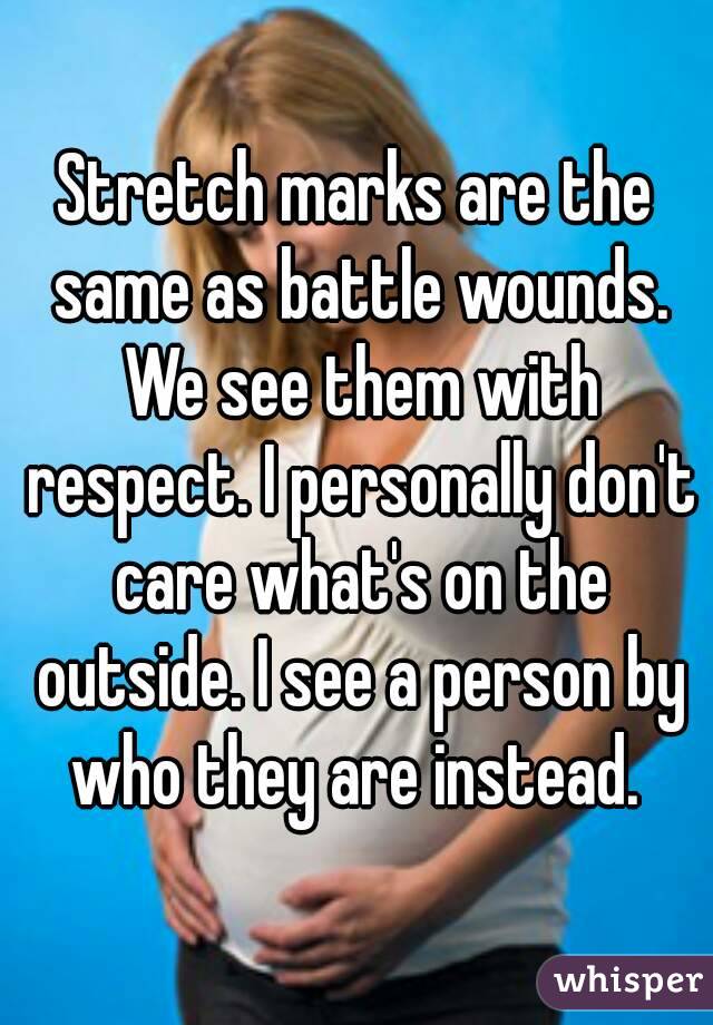 Stretch marks are the same as battle wounds. We see them with respect. I personally don't care what's on the outside. I see a person by who they are instead. 