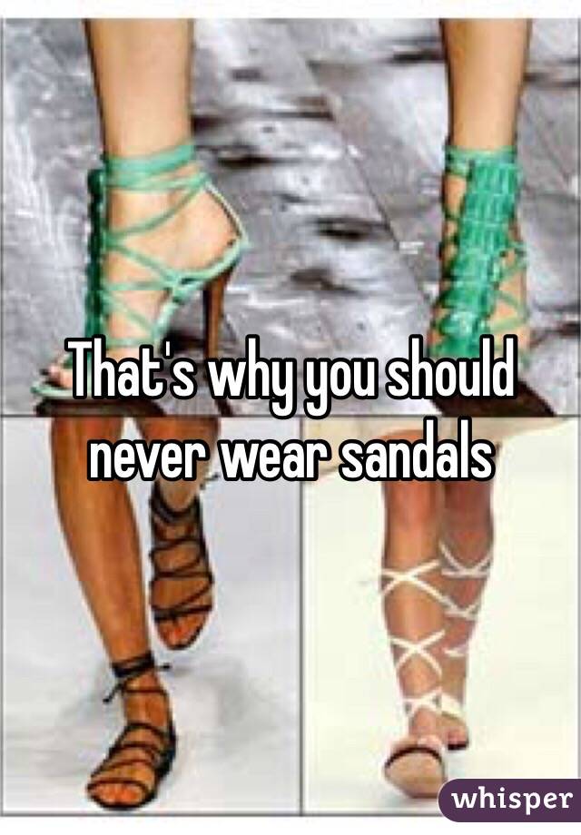 That's why you should never wear sandals 