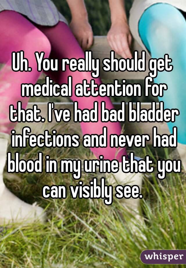 Uh. You really should get medical attention for that. I've had bad bladder infections and never had blood in my urine that you can visibly see. 