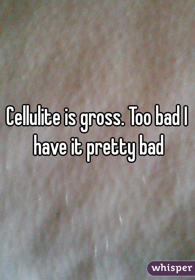 Cellulite is gross. Too bad I have it pretty bad