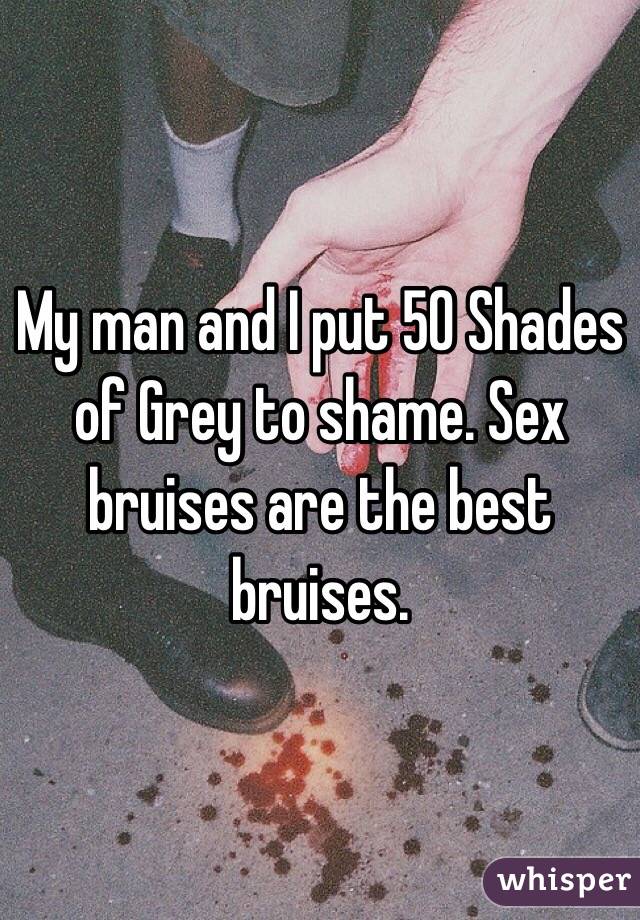 My man and I put 50 Shades of Grey to shame. Sex bruises are the best bruises. 