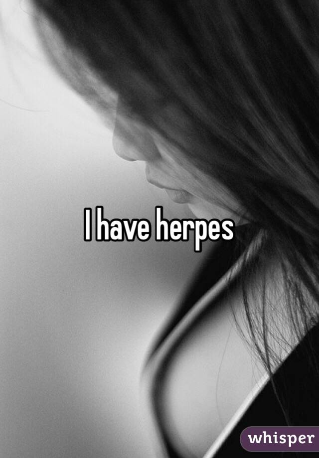 I have herpes 