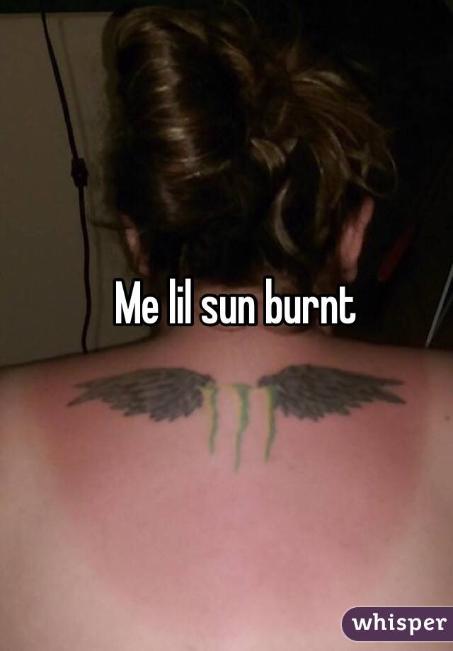 Me lil sun burnt