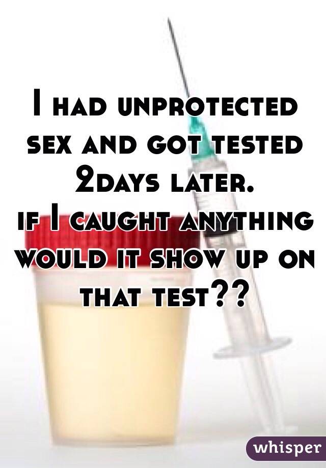 I had unprotected sex and got tested 2days later. 
if I caught anything 
would it show up on that test??