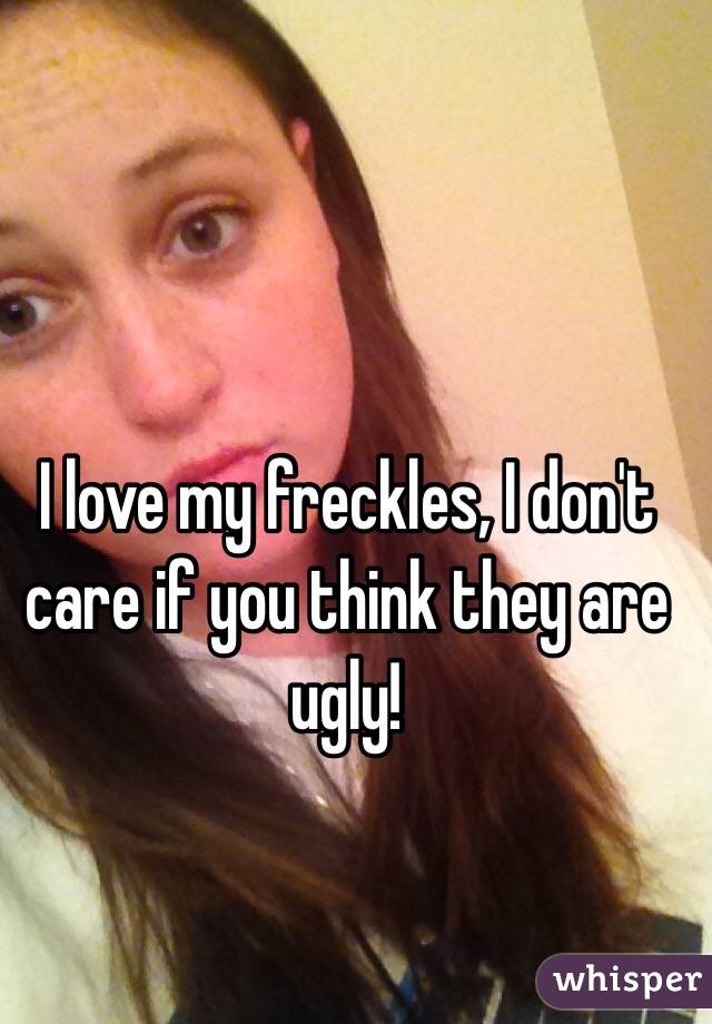 I love my freckles, I don't care if you think they are ugly! 