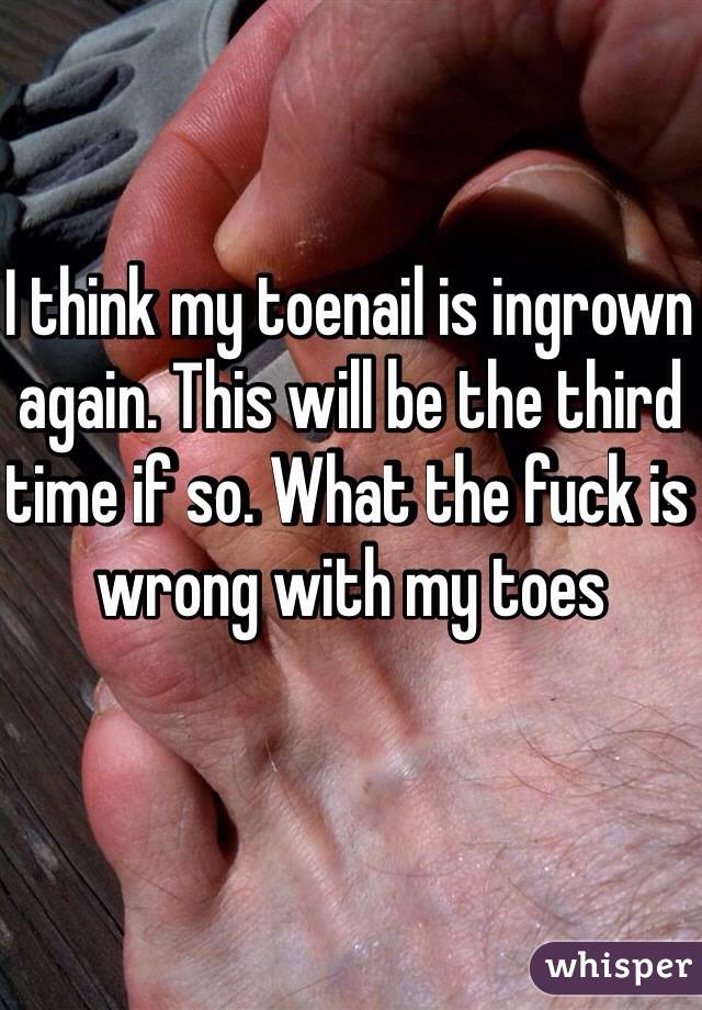 I think my toenail is ingrown again. This will be the third time if so. What the fuck is wrong with my toes 