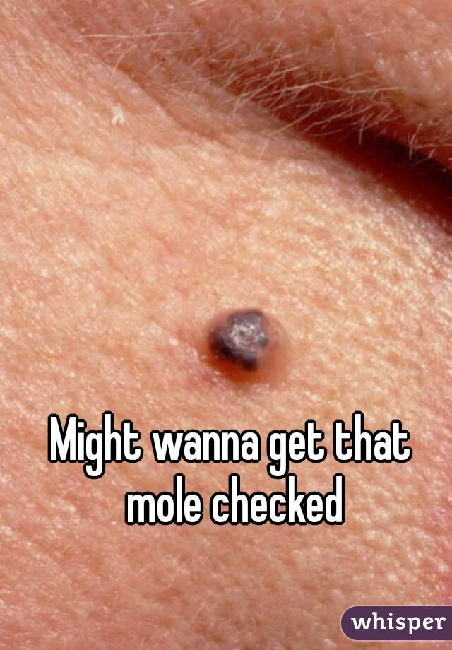 Might wanna get that mole checked