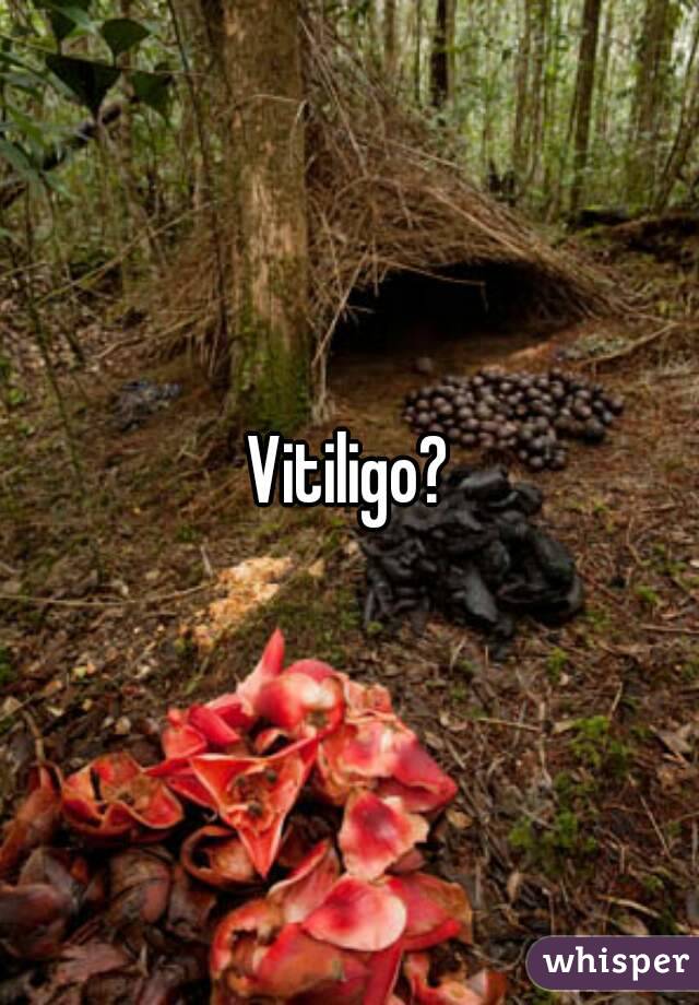 Vitiligo?