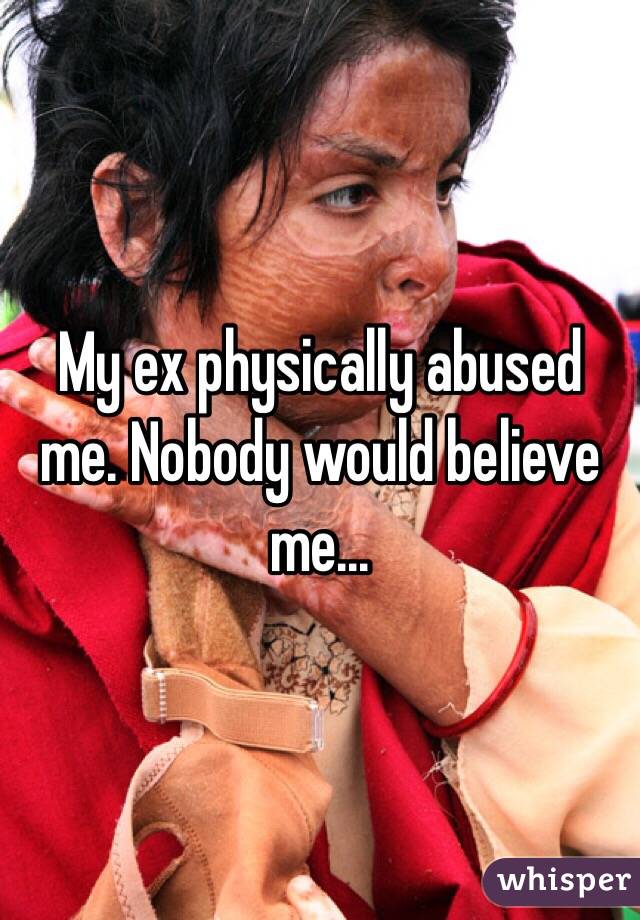 My ex physically abused me. Nobody would believe me...