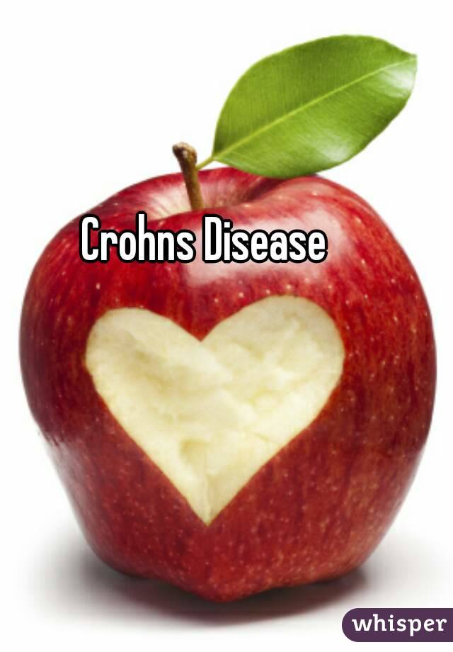 Crohns Disease