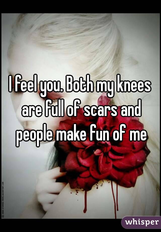 I feel you. Both my knees are full of scars and people make fun of me
