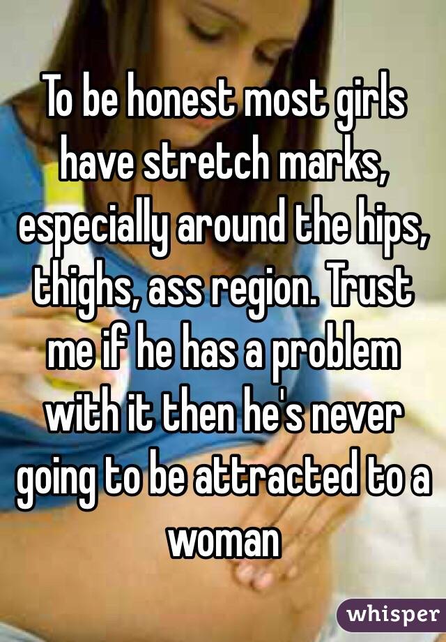 To be honest most girls have stretch marks, especially around the hips, thighs, ass region. Trust me if he has a problem with it then he's never going to be attracted to a woman 
