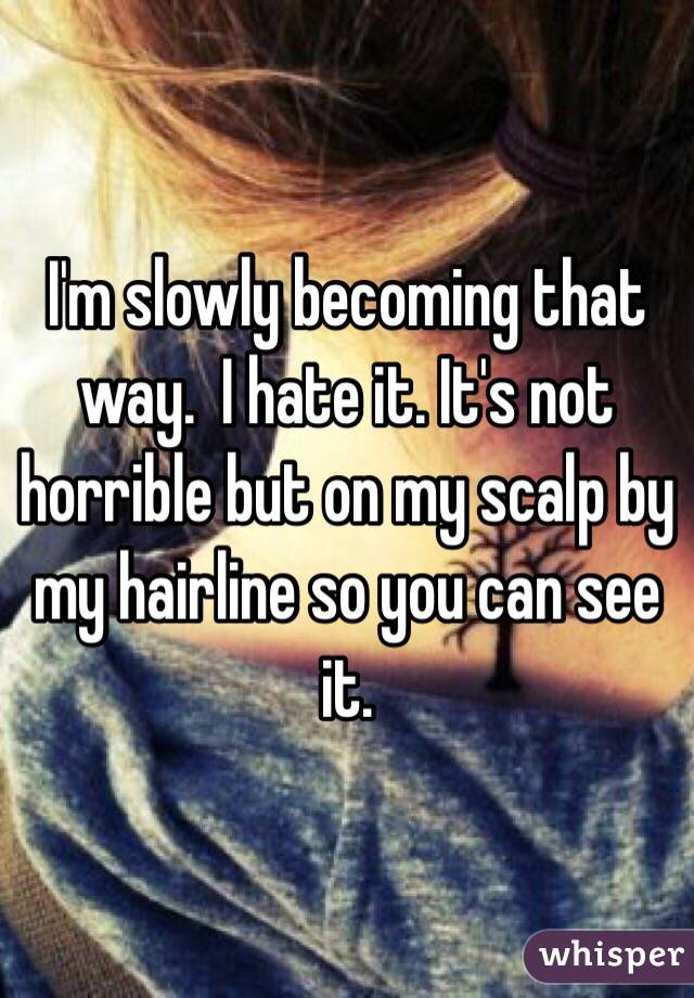 I'm slowly becoming that way.  I hate it. It's not horrible but on my scalp by my hairline so you can see it. 