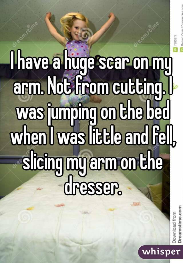 I have a huge scar on my arm. Not from cutting. I was jumping on the bed when I was little and fell, slicing my arm on the dresser.