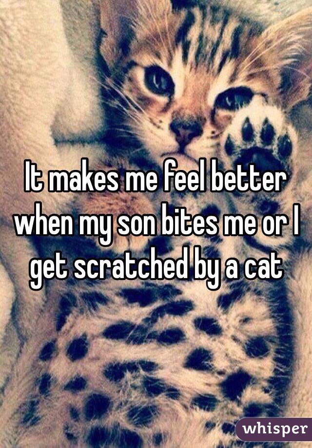It makes me feel better when my son bites me or I get scratched by a cat