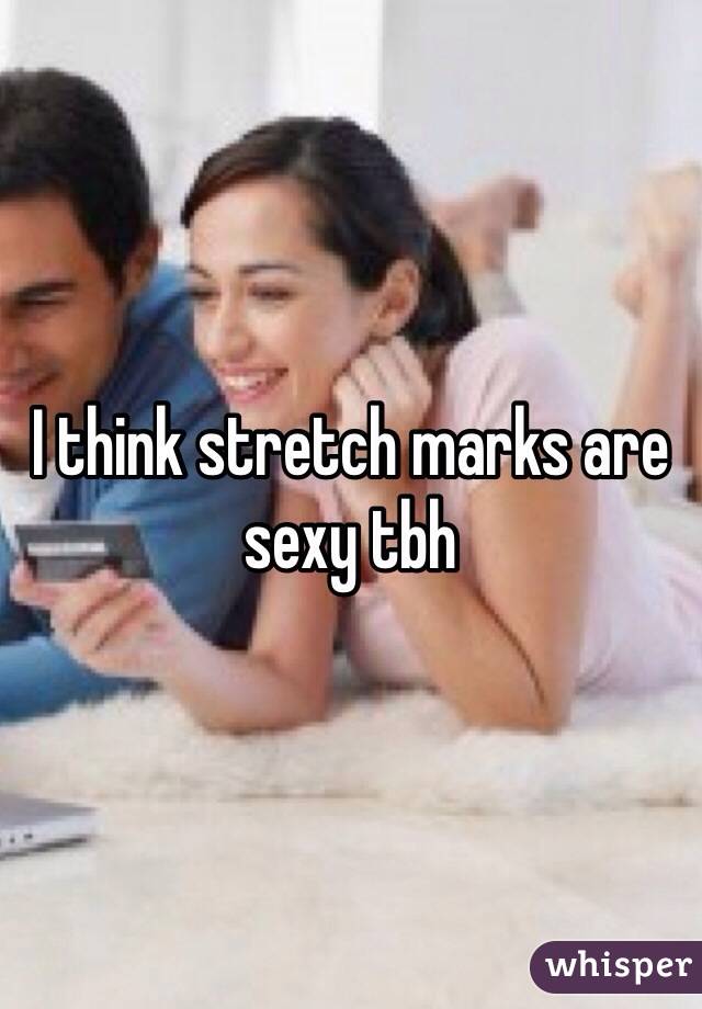 I think stretch marks are sexy tbh
