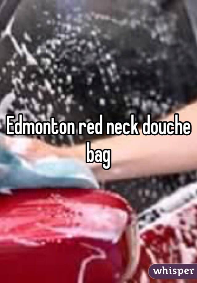 Edmonton red neck douche bag