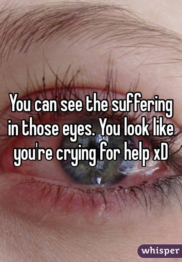 You can see the suffering in those eyes. You look like you're crying for help xD