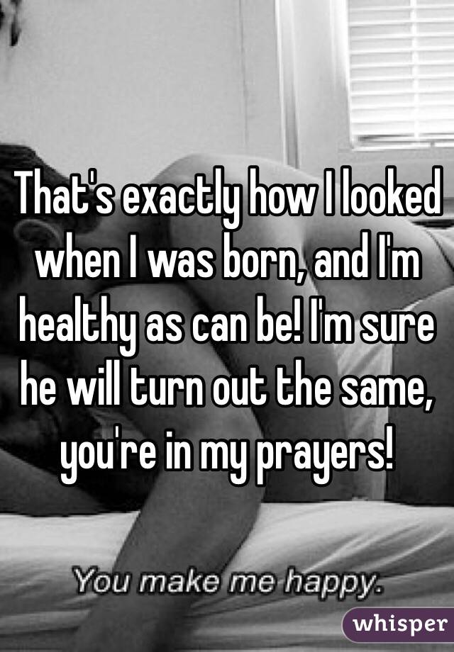That's exactly how I looked when I was born, and I'm healthy as can be! I'm sure he will turn out the same, you're in my prayers!