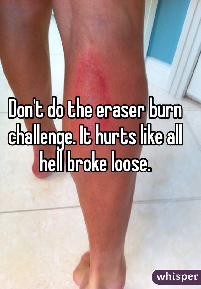 Don't do the eraser burn challenge. It hurts like all hell broke loose.