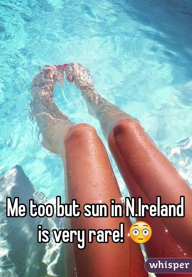 Me too but sun in N.Ireland is very rare! 😳
