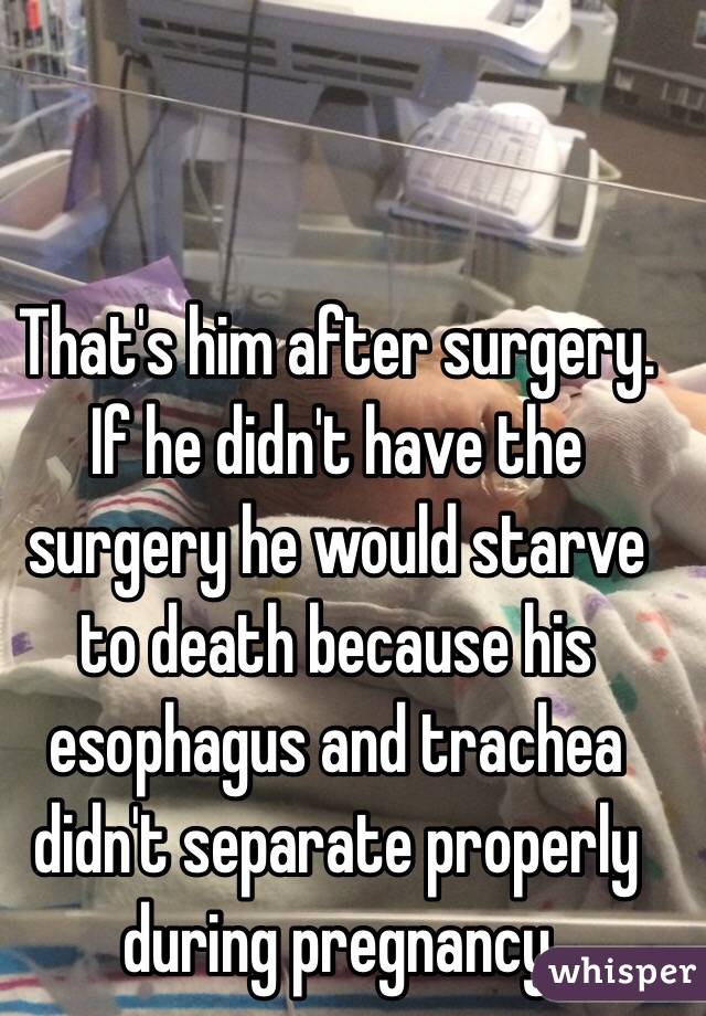 That's him after surgery. If he didn't have the surgery he would starve to death because his esophagus and trachea didn't separate properly during pregnancy 