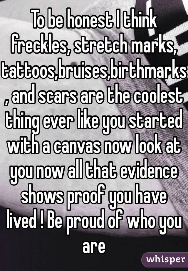 To be honest I think freckles, stretch marks, tattoos,bruises,birthmarks, and scars are the coolest thing ever like you started with a canvas now look at you now all that evidence shows proof you have lived ! Be proud of who you are 