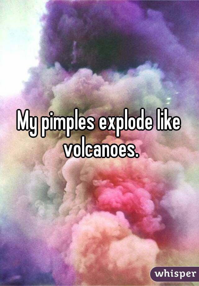 My pimples explode like volcanoes.