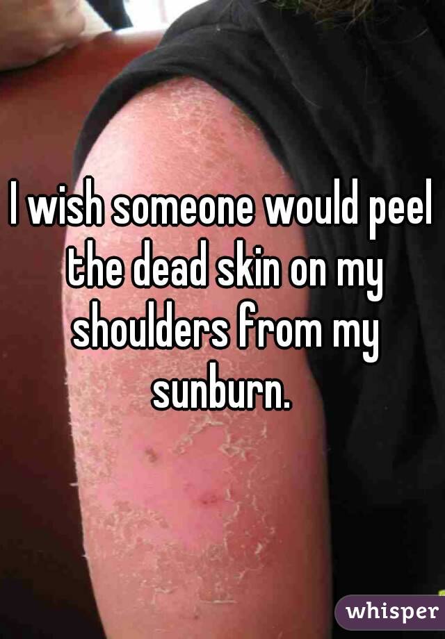 I wish someone would peel the dead skin on my shoulders from my sunburn. 