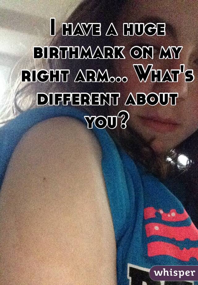 I have a huge birthmark on my right arm... What's different about you?