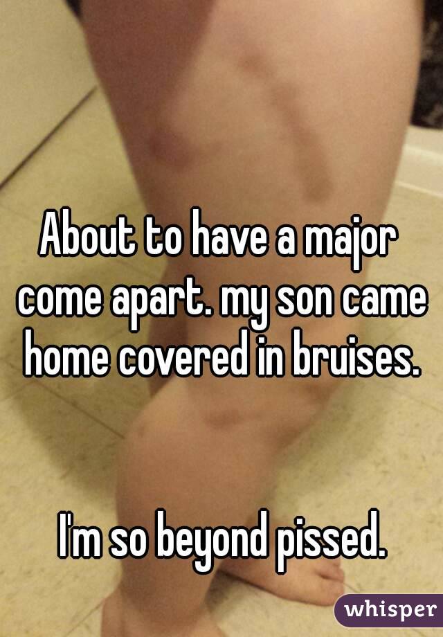 About to have a major come apart. my son came home covered in bruises.


 I'm so beyond pissed.