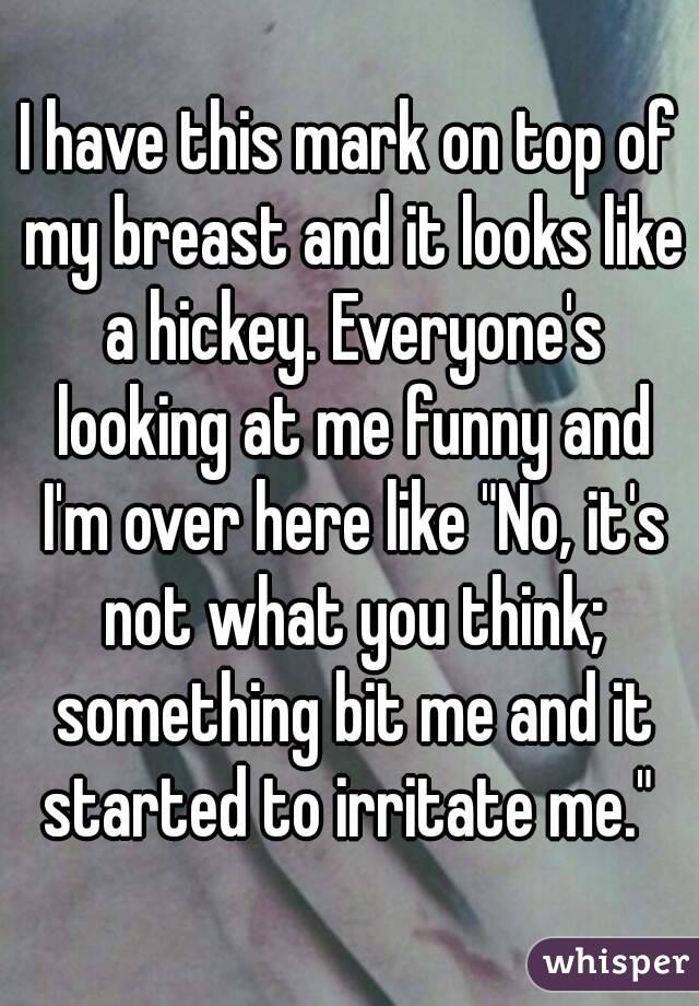I have this mark on top of my breast and it looks like a hickey. Everyone's looking at me funny and I'm over here like "No, it's not what you think; something bit me and it started to irritate me." 