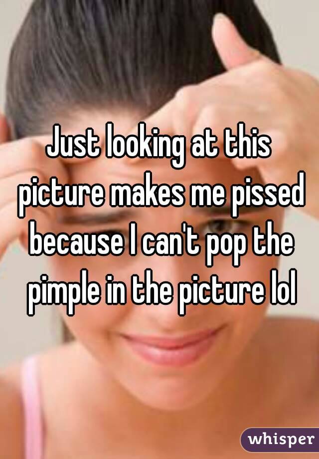 Just looking at this picture makes me pissed because I can't pop the pimple in the picture lol
