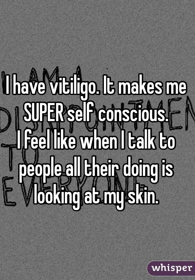 I have vitiligo. It makes me SUPER self conscious. 
I feel like when I talk to people all their doing is looking at my skin. 
