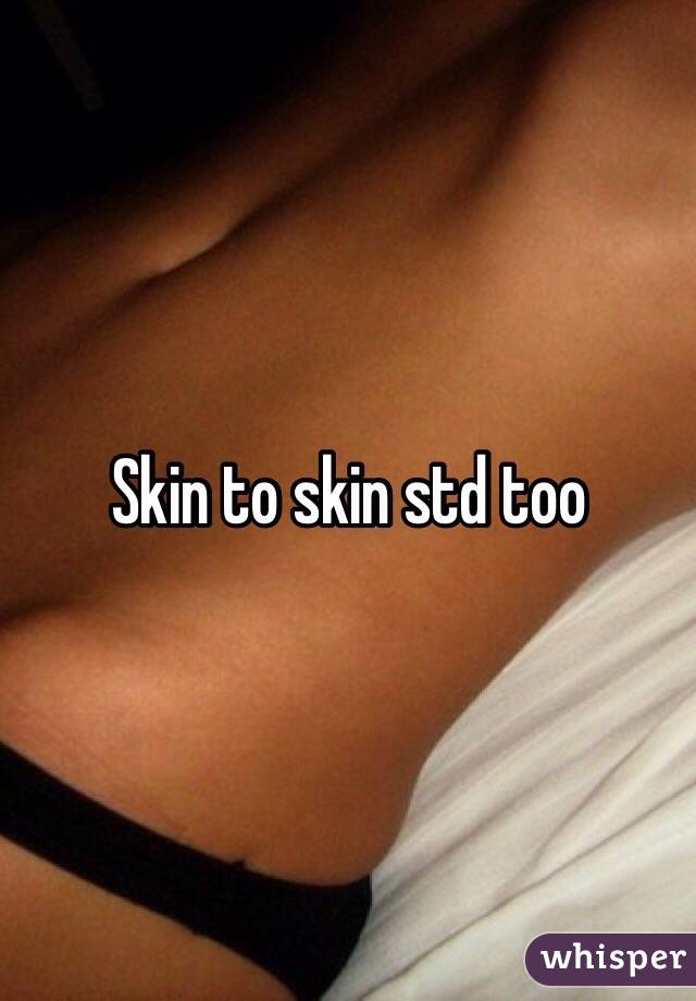 Skin to skin std too