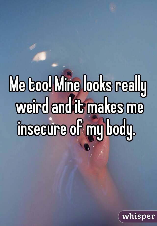 Me too! Mine looks really weird and it makes me insecure of my body.  