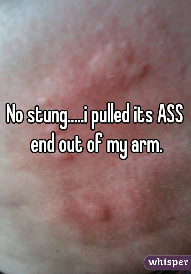 No stung.....i pulled its ASS end out of my arm.