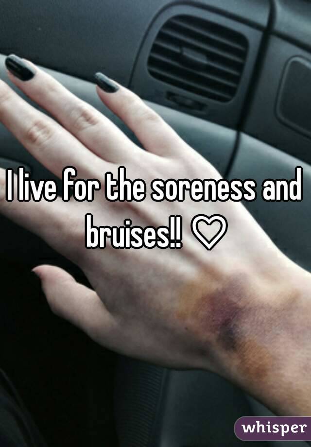 I live for the soreness and bruises!! ♡