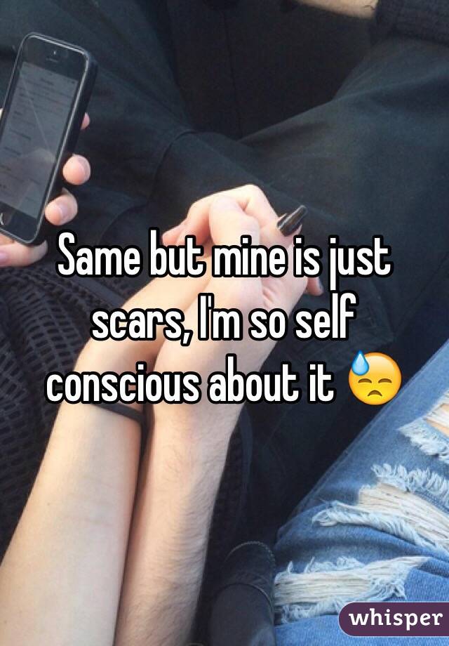 Same but mine is just scars, I'm so self conscious about it 😓
