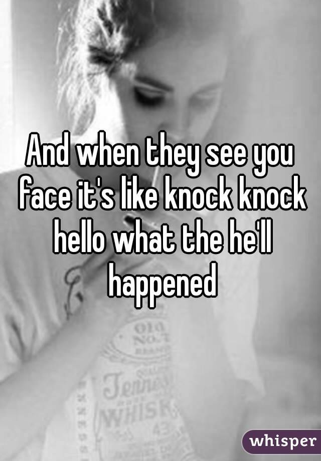 And when they see you face it's like knock knock hello what the he'll happened