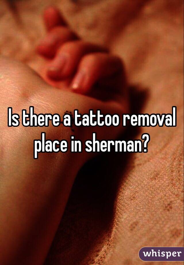 Is there a tattoo removal place in sherman? 