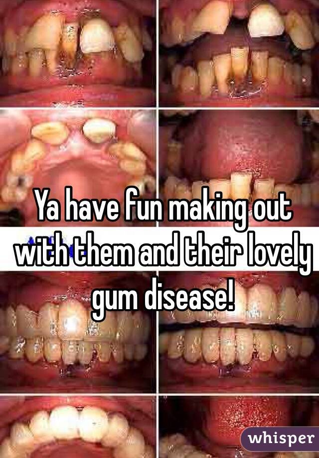 Ya have fun making out with them and their lovely gum disease!