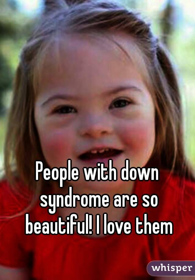 People with down syndrome are so beautiful! I love them