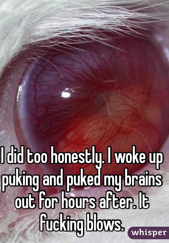 I did too honestly. I woke up puking and puked my brains out for hours after. It fucking blows. 