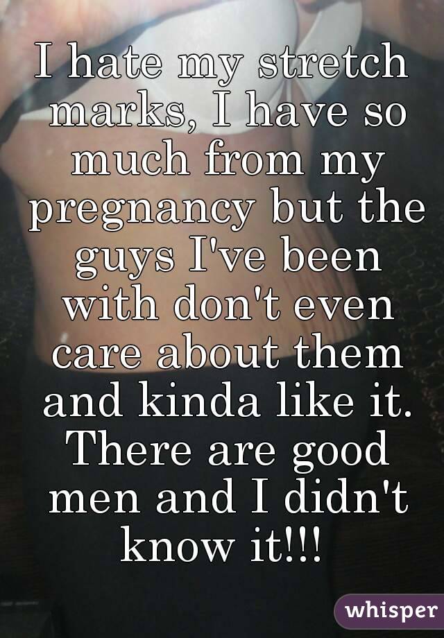 I hate my stretch marks, I have so much from my pregnancy but the guys I've been with don't even care about them and kinda like it. There are good men and I didn't know it!!! 