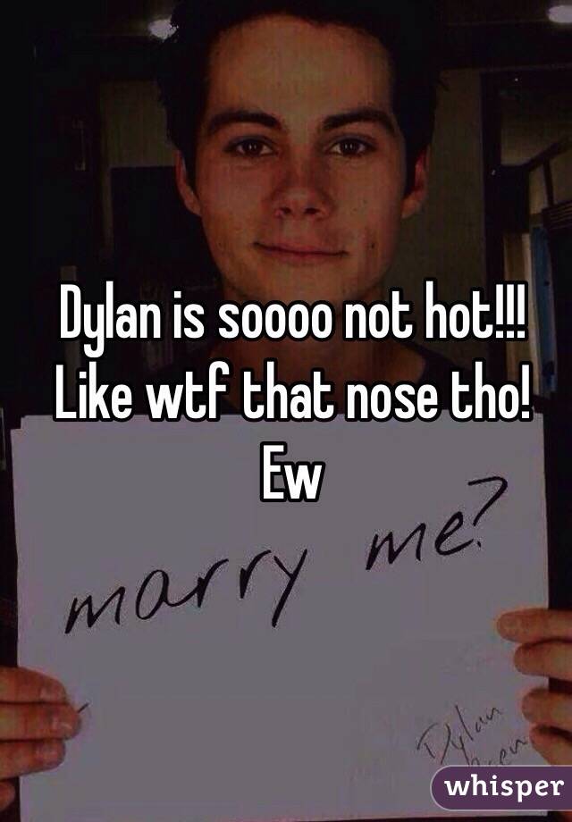 Dylan is soooo not hot!!! Like wtf that nose tho! Ew